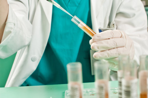 A close up of a lab technician running tests on a vial of urine.